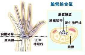手腕操促循环,有效告别鼠标手