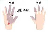 手腕操促循环,有效告别鼠标手